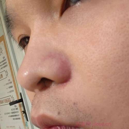 30岁岁江苏单身帅哥 - 阿拉善盟吉缘网
